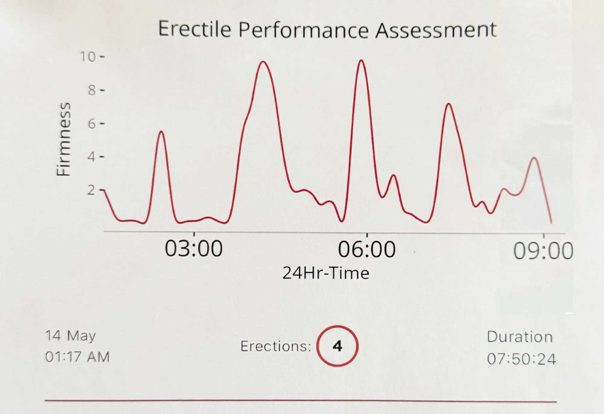 The TechRing Erectile Performance Assessment recording four erections over seven hours and fifty minutes on the same night