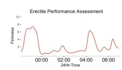 Erectile Performance Assessment chart showing two firm erections and a long flat stretch through the middle of the night