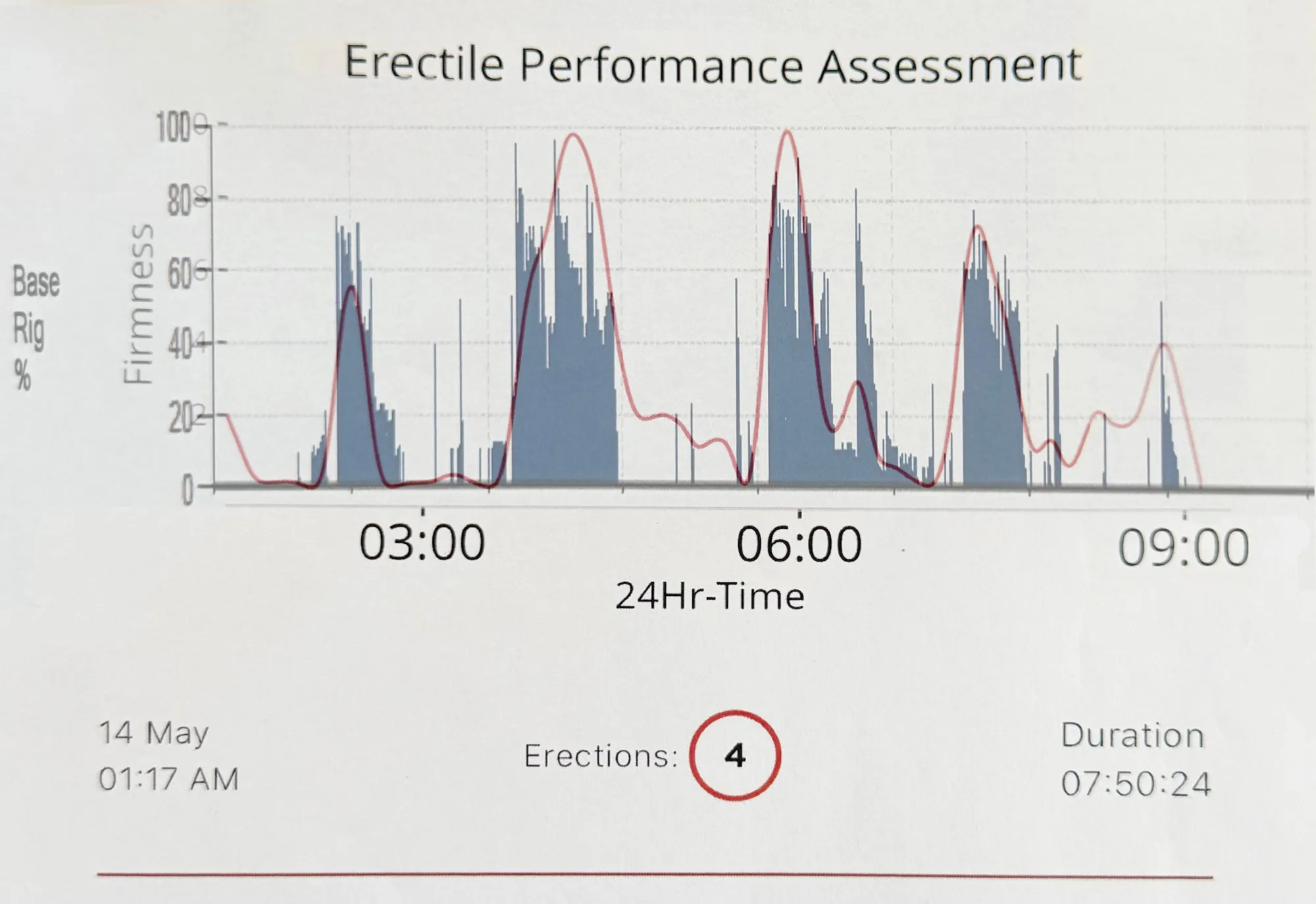 The TechRing firmness curve overlaid on the RigiScan base rigidity trace for the same night, with the peaks lining up